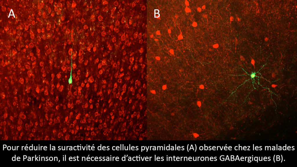 actu-sept17-parkinson-Cellule-pyramidale-et-interneurone